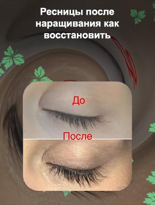 Как быстро восстановить свои ресницы после наращивания