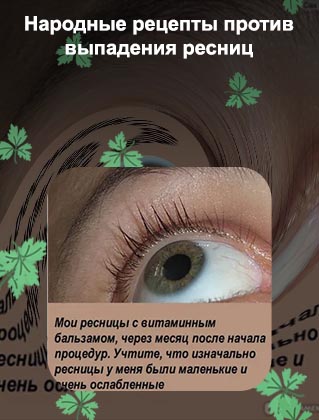 Витамины для ресниц от выпадения